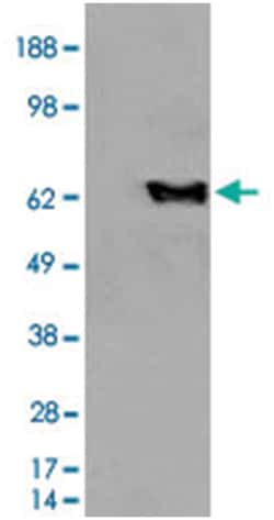 EHD2, Goat, Polyclonal Antibody, Abnova 100 &mu;g | Buy Online | Abnova | Fisher Scientific