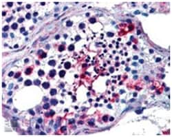 FHL1 Goat anti-Human, Mouse, Polyclonal Antibody, Abnova 100 &mu;g | Buy Online | Abnova Corporation | Fisher Scientific