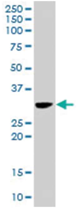 FHL1 Goat anti-Human, Polyclonal Antibody, Abnova 100 &mu;g | Buy Online | Abnova Corporation | Fisher Scientific