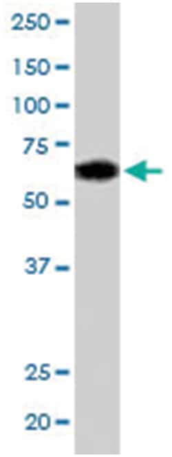 NR1H3/NR1H2, Goat, Polyclonal Antibody, Abnova 100&mu;g; Unlabeled:Antibodies,