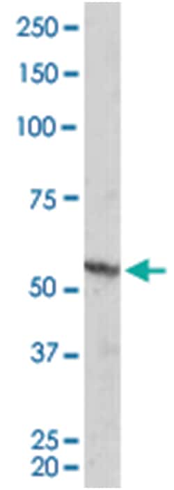 RXRB, Goat, Polyclonal Antibody, Abnova 100 &mu;g | Buy Online | Abnova Corporation | Fisher Scientific