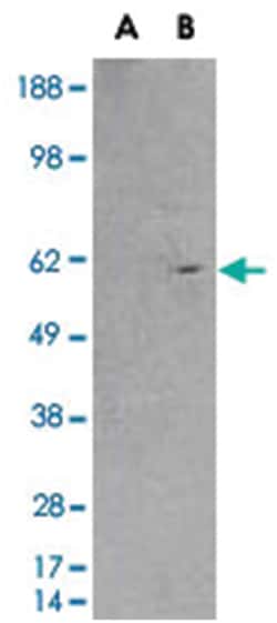 RXRB, Goat, Polyclonal Antibody, Abnova 100 &mu;g | Buy Online | Abnova Corporation | Fisher Scientific