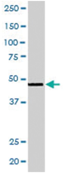 RXRG, Goat, Polyclonal Antibody, Abnova 100 &mu;g | Buy Online | Abnova Corporation | Fisher Scientific