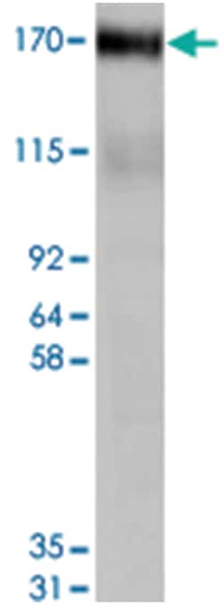 ABCC4 Goat anti-Human, Rat, Polyclonal Antibody, Abnova 100 &mu;g | Buy Online | Abnova | Fisher Scientific