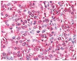 CCDC50, Goat, Polyclonal Antibody, Abnova 100 &mu;g | Buy Online | Abnova | Fisher Scientific