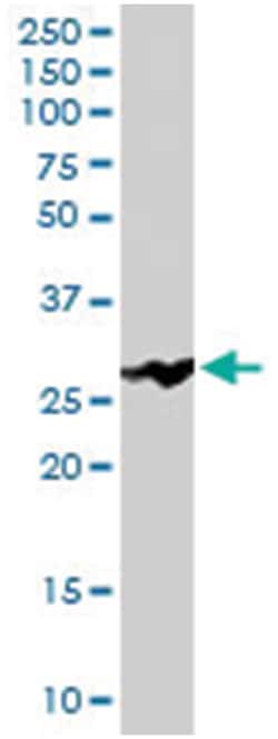 MBL2, Goat, Polyclonal Antibody, Abnova 100 &mu;g | Buy Online | Abnova Corporation | Fisher Scientific