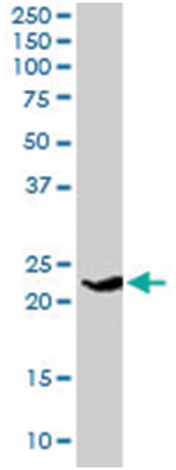 SYNGR4, Goat, Polyclonal Antibody, Abnova 100&mu;g; Unlabeled:Antibodies,