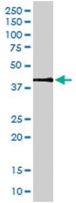 MAPK1, Goat, Polyclonal Antibody, Abnova 100 &mu;g | Buy Online | Abnova Corporation | Fisher Scientific