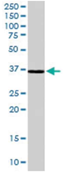HSD11B1 Goat anti-Human, Polyclonal Antibody, Abnova 100 &mu;g | Buy Online | Abnova Corporation | Fisher Scientific