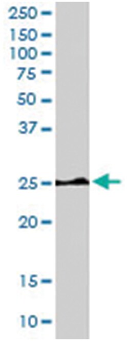 HSD17B10, Goat, Polyclonal Antibody, Abnova 100&mu;g; Unlabeled:Antibodies,