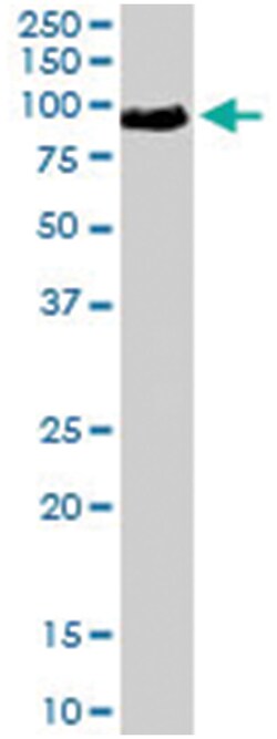 TRAK1, Goat, Polyclonal Antibody, Abnova 100 &mu;g | Buy Online | Abnova | Fisher Scientific