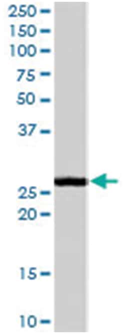 GSTM1/GSTM2, Goat, Polyclonal Antibody, Abnova 100 &mu;g | Buy Online | Abnova Corporation | Fisher Scientific