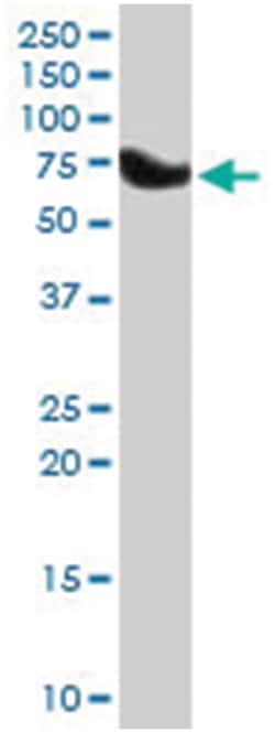ZDHHC17, Goat, Polyclonal Antibody, Abnova 100 &mu;g | Buy Online | Abnova | Fisher Scientific