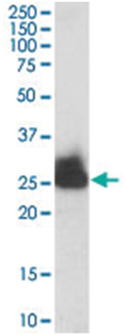TPI1, Goat, Polyclonal Antibody, Abnova 100 &mu;g | Buy Online | Abnova Corporation | Fisher Scientific