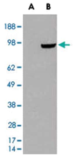 PDE5A, Goat, Polyclonal Antibody, Abnova 100&mu;g; Unlabeled:Antibodies,