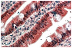 FGFR1 Goat anti-Human, Polyclonal Antibody, Abnova 100&mu;g; Unlabeled:Antibodies,