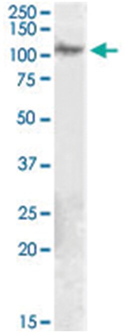 ITGB5, Goat, Polyclonal Antibody, Abnova 100 &mu;g | Buy Online | Abnova Corporation | Fisher Scientific