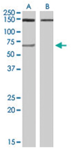 ACHE Goat anti-Human, Polyclonal Antibody, Abnova 100 &mu;g | Buy Online | Abnova Corporation | Fisher Scientific