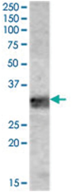 MYD88, Goat, Polyclonal Antibody, Abnova 100 &mu;g | Buy Online | Abnova Corporation | Fisher Scientific