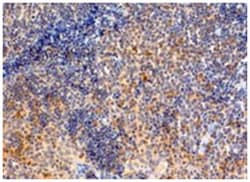 MYD88, Goat, Polyclonal Antibody, Abnova 100 &mu;g | Buy Online | Abnova Corporation | Fisher Scientific