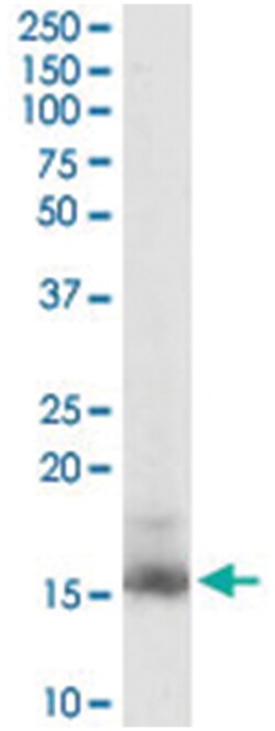 RBP1, Goat, Polyclonal Antibody, Abnova 100 &mu;g | Buy Online | Abnova Corporation | Fisher Scientific
