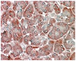 RBP1, Goat, Polyclonal Antibody, Abnova 100 &mu;g | Buy Online | Abnova Corporation | Fisher Scientific
