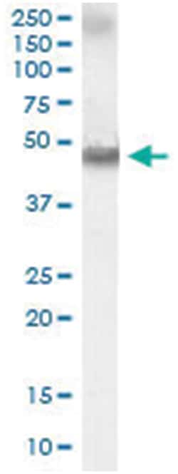 RARA, Goat, Polyclonal Antibody, Abnova 100 &mu;g | Buy Online | Abnova Corporation | Fisher Scientific