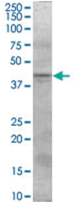 SERPINI2, Goat, Polyclonal Antibody, Abnova 100&mu;g; Unlabeled:Antibodies,
