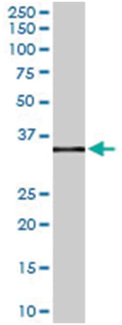 FCGR2B, Goat, Polyclonal Antibody, Abnova 100 &mu;g | Buy Online | Abnova Corporation | Fisher Scientific