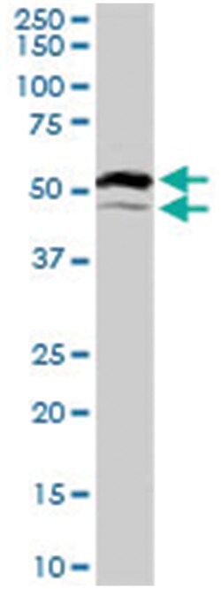 HNF4A, Goat, Polyclonal Antibody, Abnova 100&mu;g; Unlabeled:Antibodies,