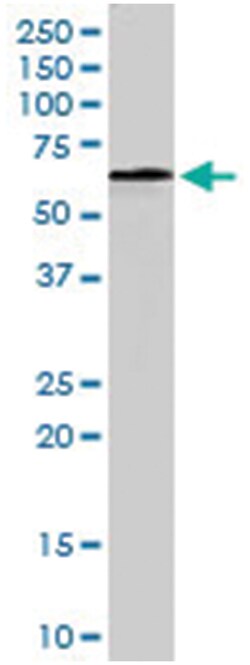 PPP2R1A, Goat, Polyclonal Antibody, Abnova 100&mu;g; Unlabeled:Antibodies,