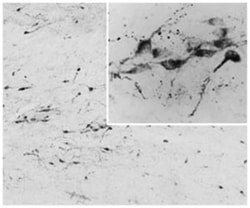 AGRP, Goat, Polyclonal Antibody, Abnova 100&mu;g; Unlabeled:Antibodies,