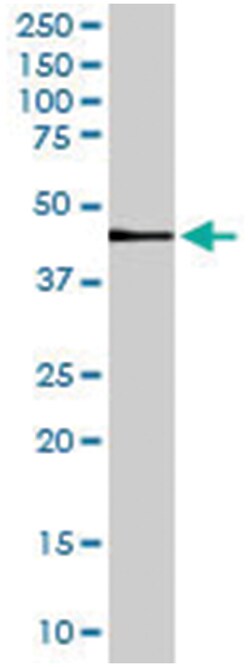 MC3R, Goat, Polyclonal Antibody, Abnova 100 &mu;g | Buy Online | Abnova Corporation | Fisher Scientific