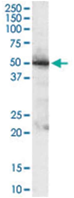 PDHX, Goat, Polyclonal Antibody, Abnova 100 &mu;g | Buy Online | Abnova Corporation | Fisher Scientific