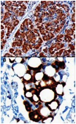 PDHX, Goat, Polyclonal Antibody, Abnova 100 &mu;g | Buy Online | Abnova Corporation | Fisher Scientific
