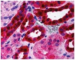 RICTOR, Goat, Polyclonal Antibody, Abnova 100 &mu;g | Buy Online | Abnova Corporation | Fisher Scientific