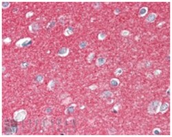 SNAP25, Goat, Polyclonal Antibody, Abnova 100 &mu;g | Buy Online | Abnova Corporation | Fisher Scientific