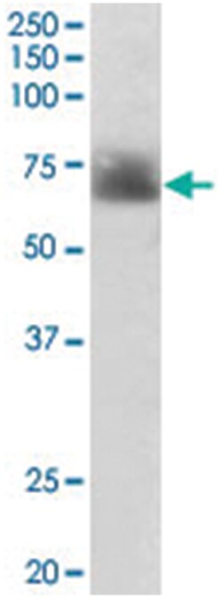 SLC6A4 Goat anti-Human, Polyclonal Antibody, Abnova 100&mu;g; Unlabeled:Antibodies,