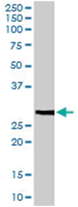 FFAR1, Goat, Polyclonal Antibody, Abnova 100 &mu;g | Buy Online | Abnova Corporation | Fisher Scientific