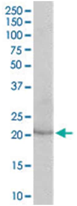 LCN2 Goat anti-Human, Polyclonal Antibody, Abnova 100 &mu;g | Buy Online | Abnova Corporation | Fisher Scientific