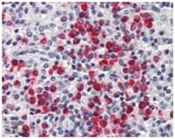 LCN2 Goat anti-Human, Polyclonal Antibody, Abnova 100 &mu;g | Buy Online | Abnova Corporation | Fisher Scientific