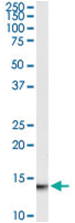 MIF, Goat, Polyclonal Antibody, Abnova 100 &mu;g | Buy Online | Abnova Corporation | Fisher Scientific