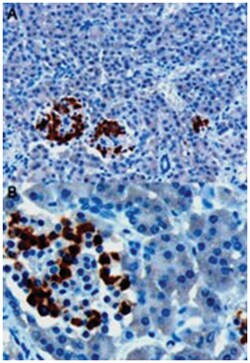 CCKAR, Goat, Polyclonal Antibody, Abnova 100&mu;g; Unlabeled:Antibodies,