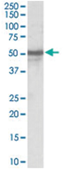 NPY5R, Goat, Polyclonal Antibody, Abnova 100 &mu;g | Buy Online | Abnova Corporation | Fisher Scientific