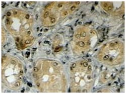 LRP5, Goat, Polyclonal Antibody, Abnova 100 &mu;g | Buy Online | Abnova Corporation | Fisher Scientific
