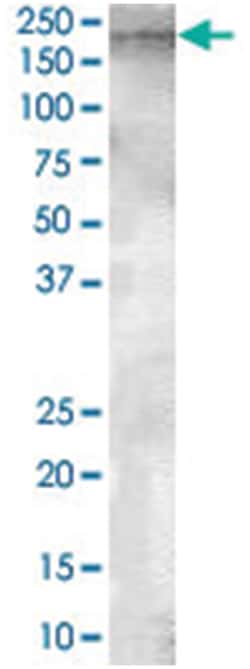 ENPEP, Goat, Polyclonal Antibody, Abnova 100 &mu;g | Buy Online | Abnova Corporation | Fisher Scientific