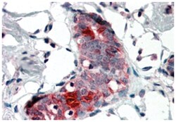 SCGB2A2, Goat, Polyclonal Antibody, Abnova 100 &mu;g | Buy Online | Abnova Corporation | Fisher Scientific