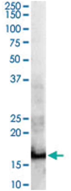 SH2D1A Goat anti-Human, Polyclonal Antibody, Abnova 100 &mu;g | Buy Online | Abnova Corporation | Fisher Scientific