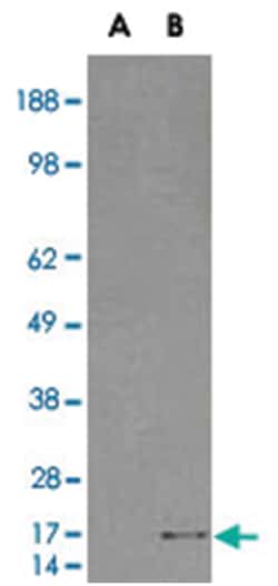 SH2D1A Goat anti-Human, Polyclonal Antibody, Abnova 100 &mu;g | Buy Online | Abnova Corporation | Fisher Scientific