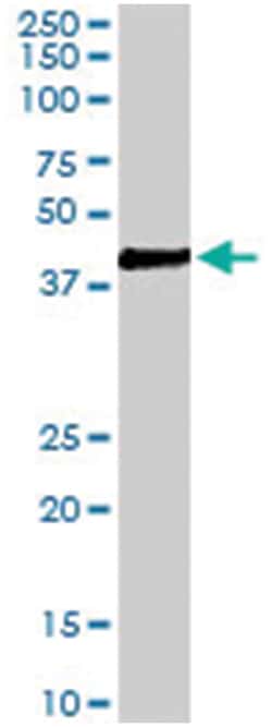 VPS37C, Goat, Polyclonal Antibody, Abnova 100 &mu;g | Buy Online | Abnova Corporation | Fisher Scientific